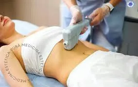 El Impacto de HIFU en la Innovación Estética: Una Mirada Detallada desde Fundación Llor